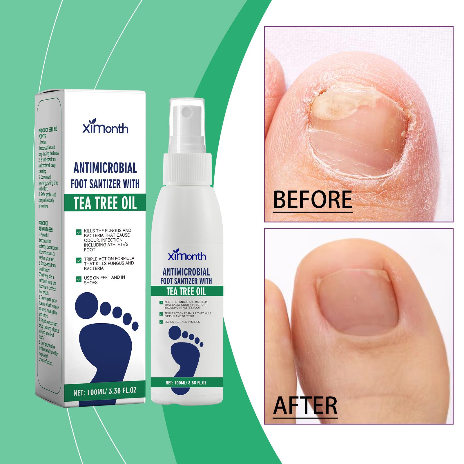 Ximonth Foot Care Treatment – Deep Hydration Moisturizer for Dry Heels & Deodorant Foot Essence