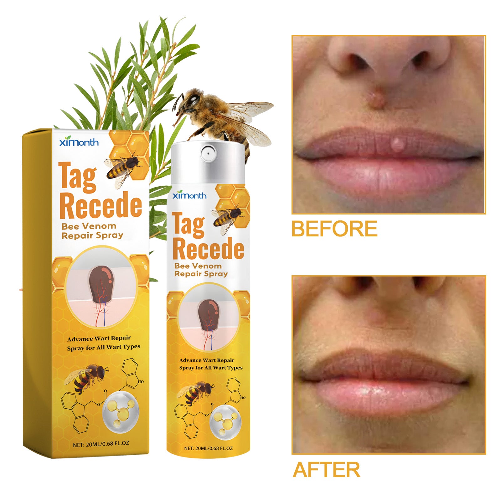 Ximonth Bee Venom Skin Conditioning Spray – Smooth & Refine Bumpy Skin Texture