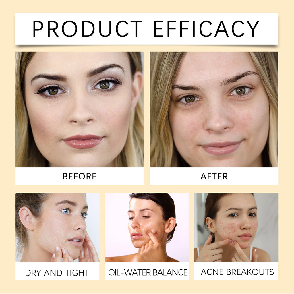 EELHOE Centella Soothing Oil Cleanser – Lightweight, Water-Rinseable Makeup Remover for Face, Eyes & Lips (Vegan, Fragrance-Free, Non-Comedogenic)
