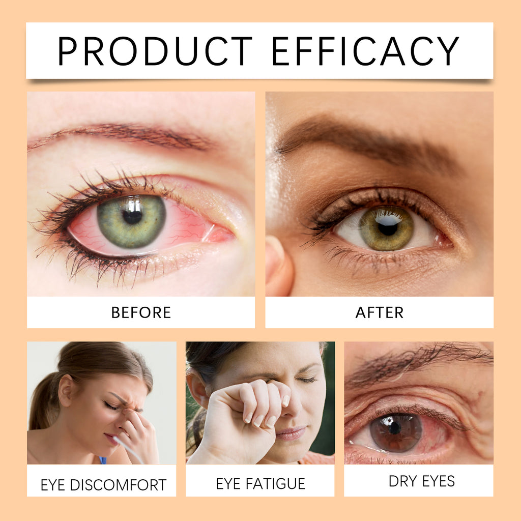 Ximonth Honey Eye Comfort Mist – Refreshing & Moisturizing Eye Area Spray for Dry & Tired Eyes