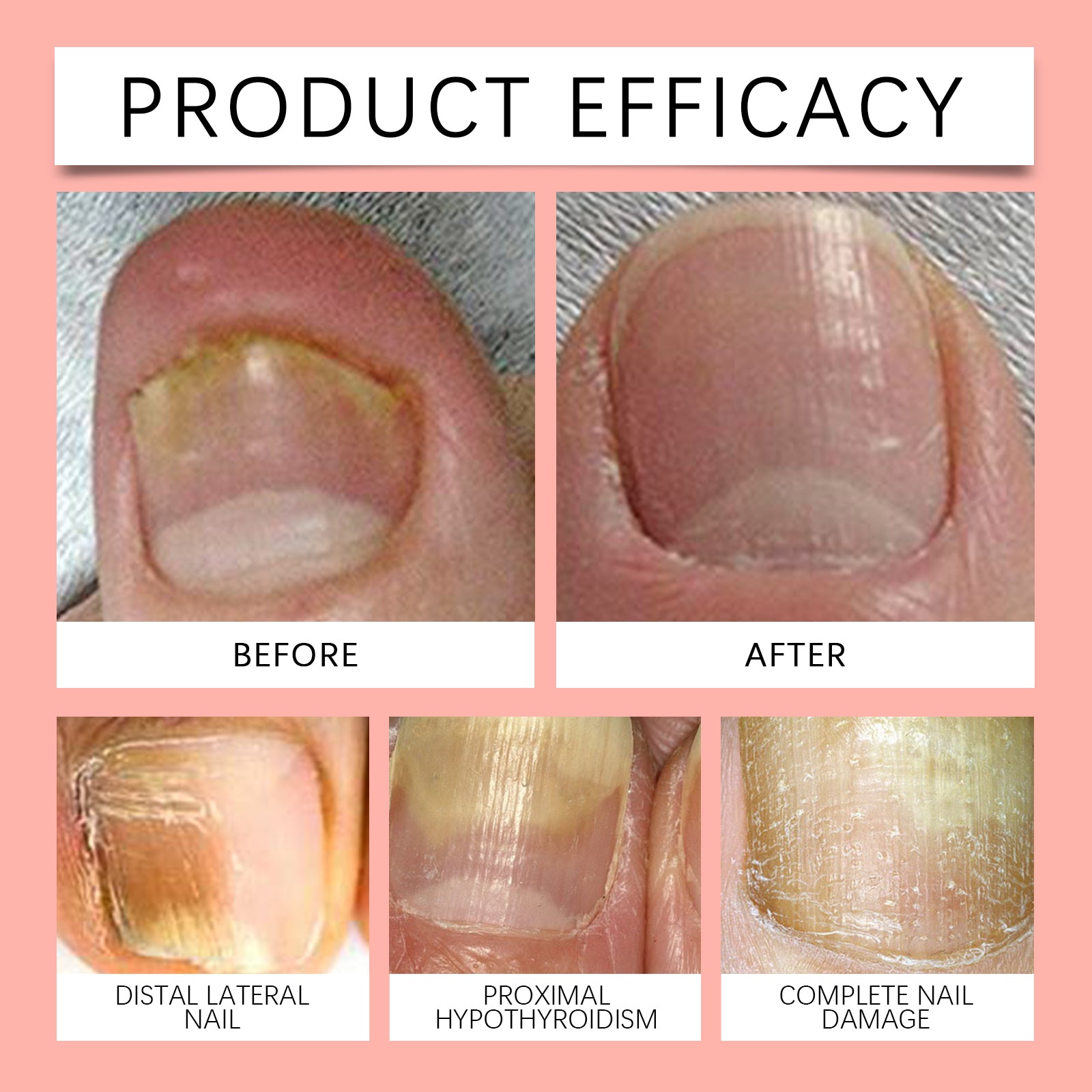 Ximonth Nail Care Patches – Gentle Cuticle Softening & Nourishing Nail Sheets